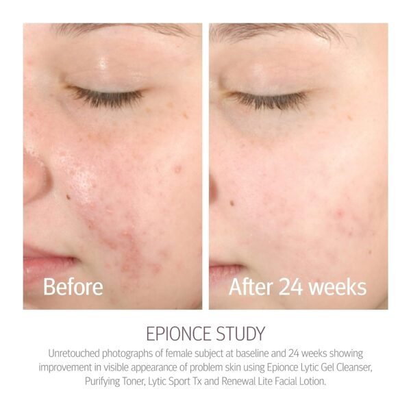 Epionce Purifying Toner - Image 5