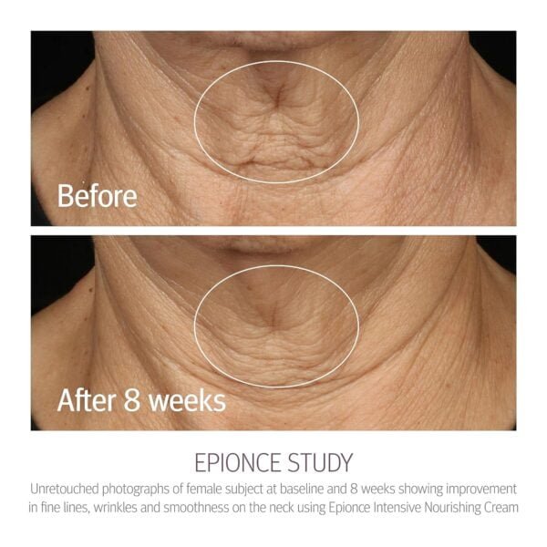 Epionce Intensive Nourishing Cream - Image 4